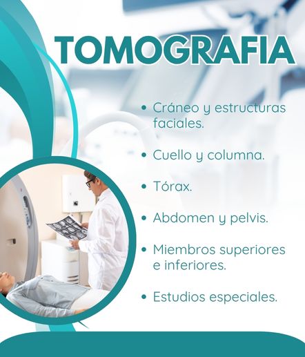 Servicio de tomografía